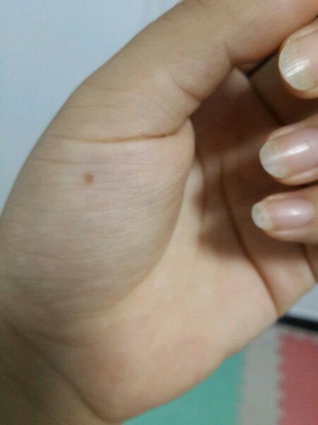 食指有痣代表贵人是兄弟姐妹,中指上有痣代表贵人就是自己,无名指代表
