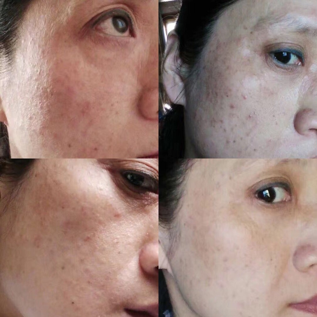 因为“它”不知道毁了多少女人的脸?_第1页_减压一族_时尚_西祠胡同