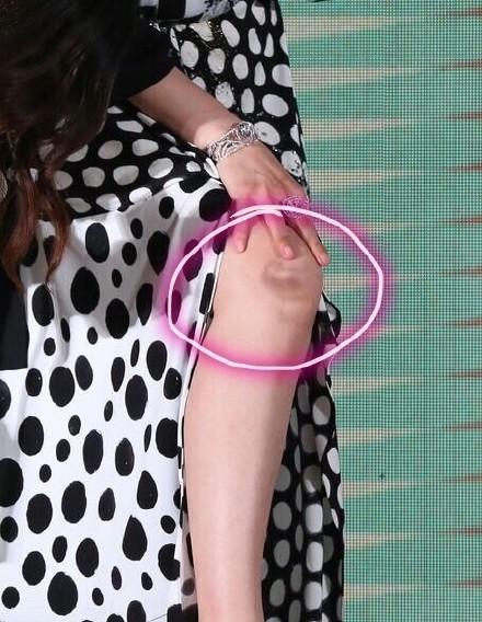 baby录节目被砸受伤 用生命录节目还有谁？(图9)