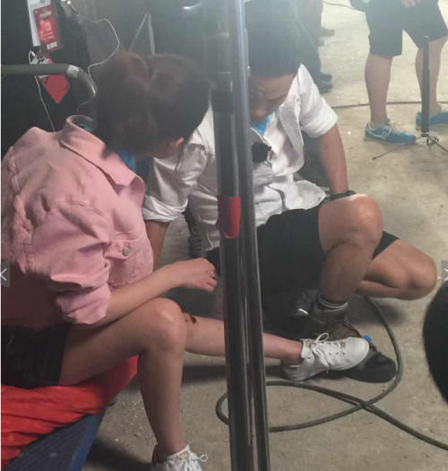 baby录节目被砸受伤 用生命录节目还有谁？(图20)