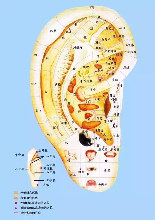 耳穴高清大图