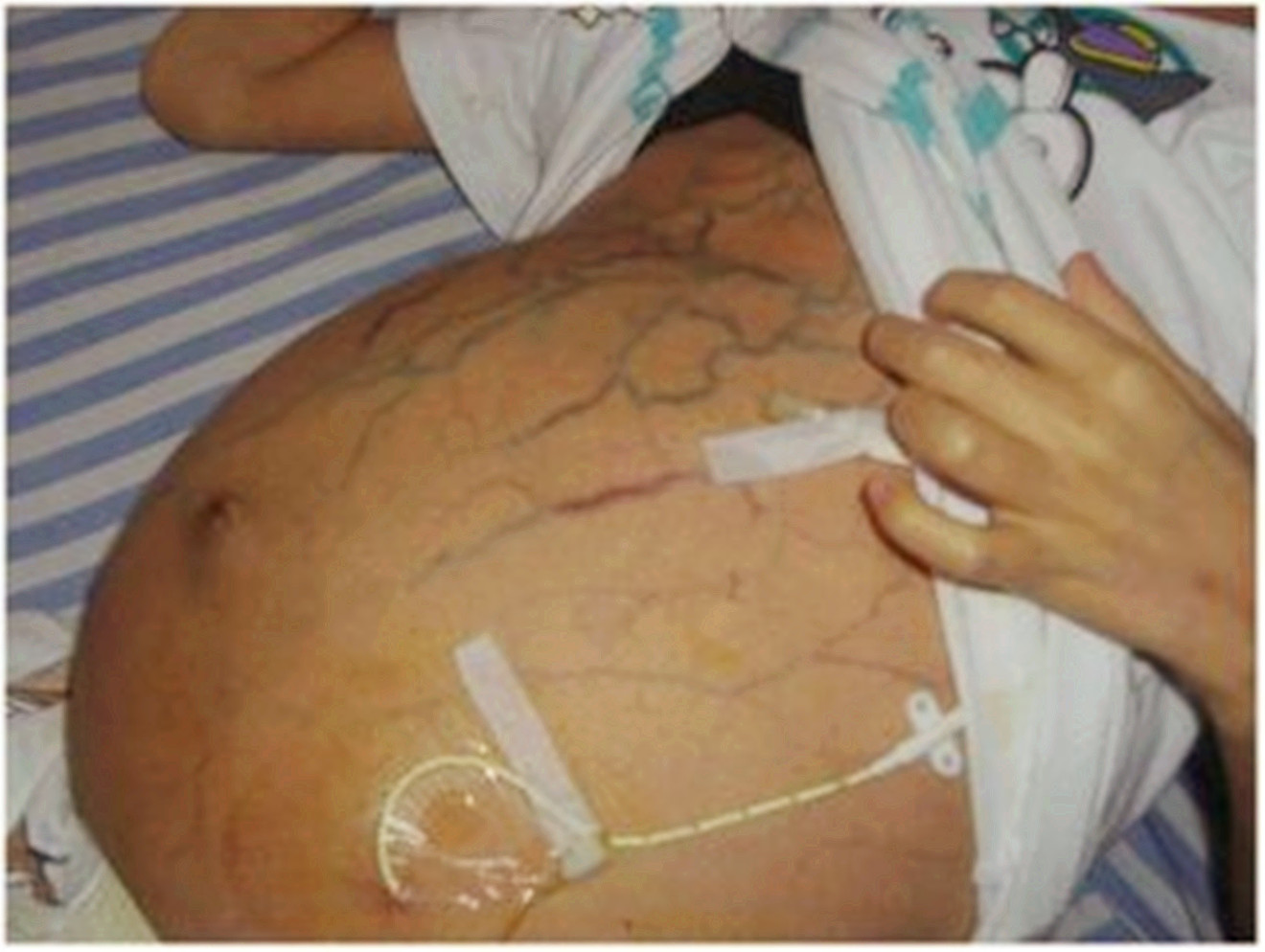 男子剧烈腹痛被送急诊,抢救无效不幸死亡,只因