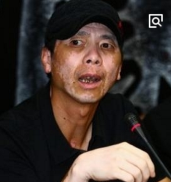 冯小刚导演有钱没钱都不会去治白癜风,挺赞同的 冯小刚导演有钱没钱都不会去治白癜风,挺赞同的