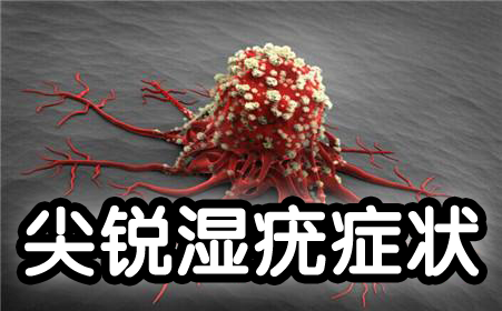 上海明珠医院性疾病专家提醒:治疗湿疣勿盲目