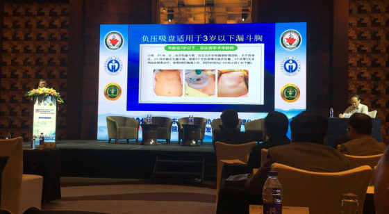 漏斗胸别着急做手术3D帮忙技术来打印-中华健如何v漏斗排骨汤图片