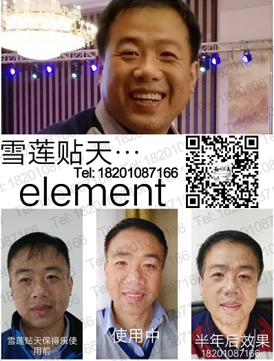 感恩金天国际天保得乐调理好了我的白癫疯