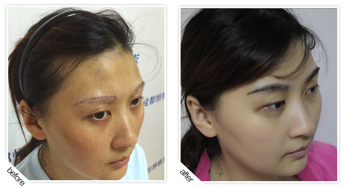 眉毛对比图.jpg
