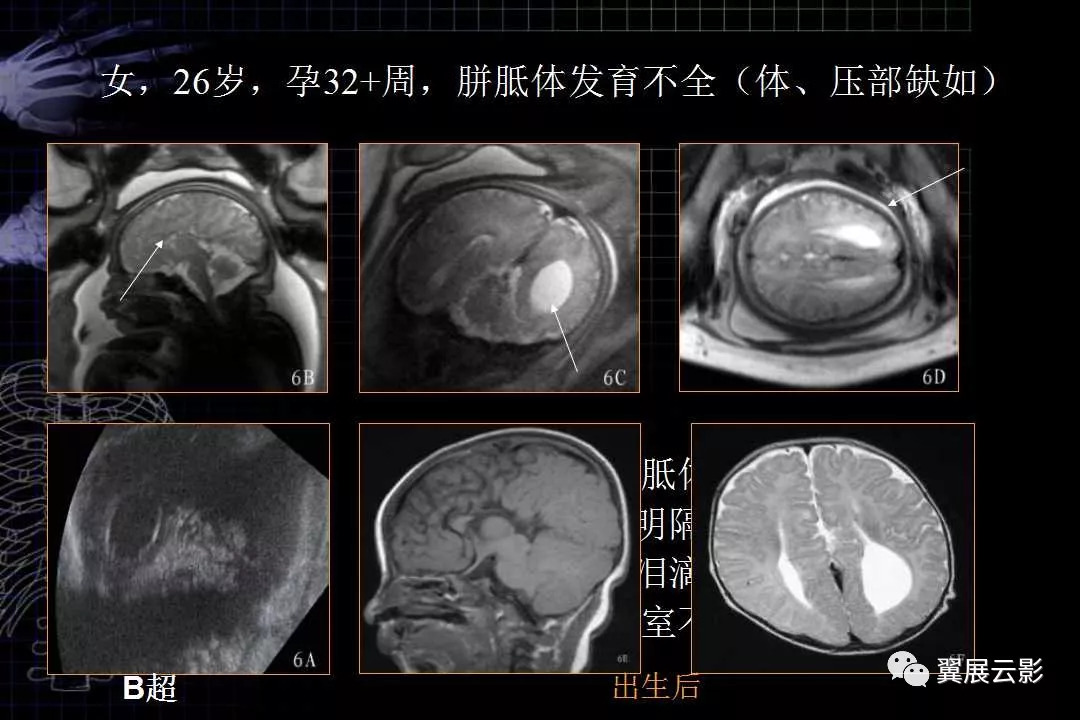 胎儿磁共振解剖图谱