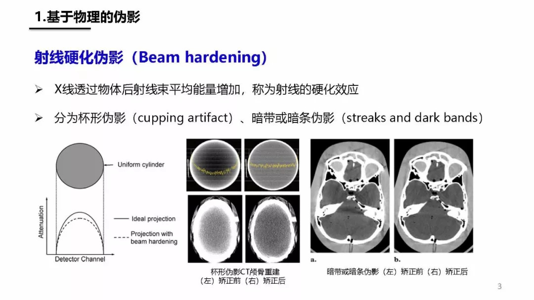 ct伪影产生机制及图像表现