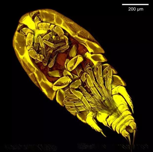 10种水中常见的细菌在显微镜下的样子,真令人害怕! 10种水中常见的细菌在显微镜下的样子,真令人害怕!