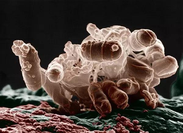 10种水中常见的细菌在显微镜下的样子,真令人害怕! 10种水中常见的细菌在显微镜下的样子,真令人害怕!