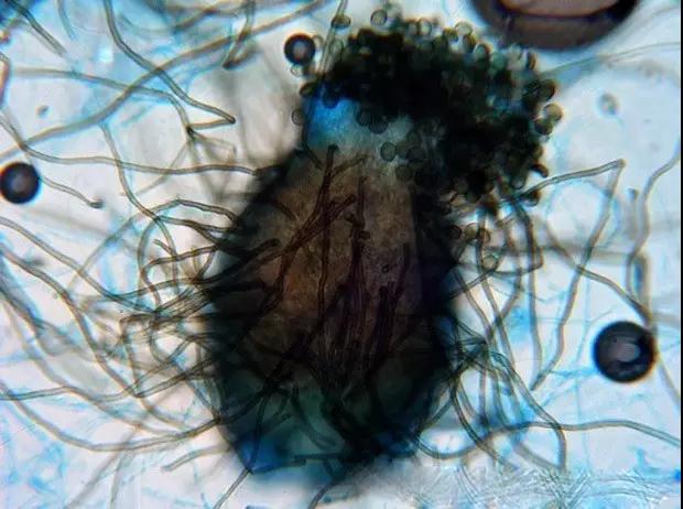 10种水中常见的细菌在显微镜下的样子，真令人害怕！