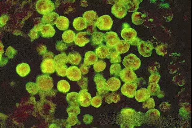 10种水中常见的细菌在显微镜下的样子,真令人害怕!
