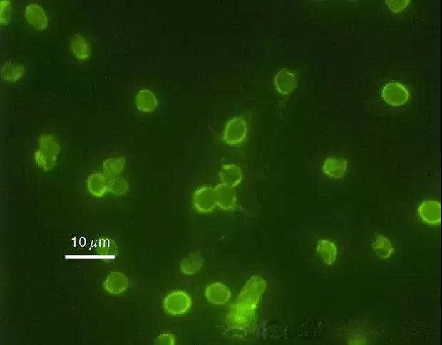 肠道沙门氏菌(salmonella enterica)