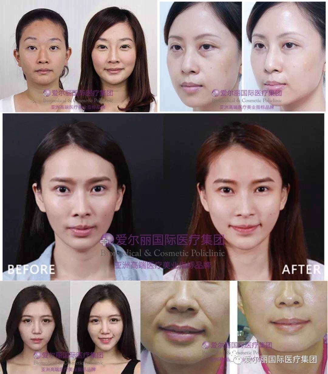 医疗-台湾爱尔丽医美北京门诊/Taiwan Airlee biomedical & cosmetic policlinic ...