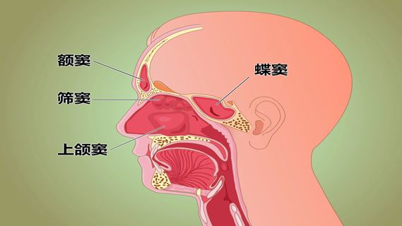 鼻窦炎是常见的健康问题之一,发病率约为30%.