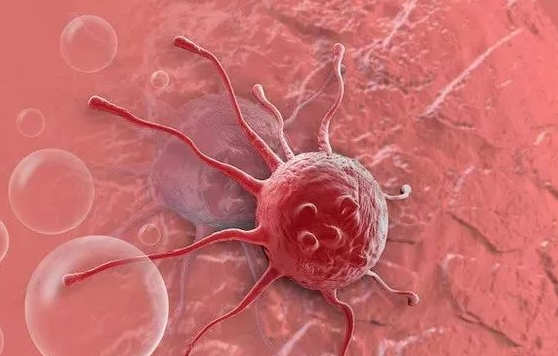 肿瘤究竟是如何扩散的？患者又该如何预防？