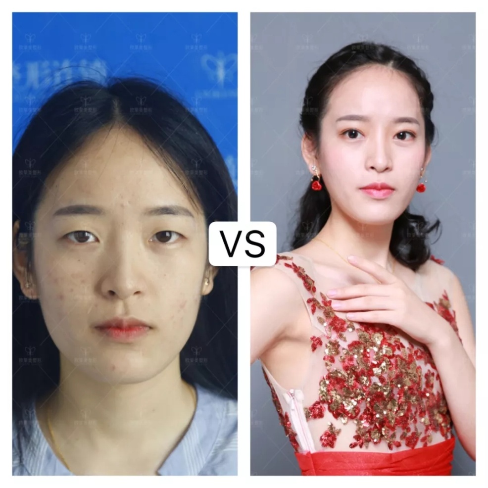 E:\sunny-1\xwy\10.31\2\640.webp (12).jpg