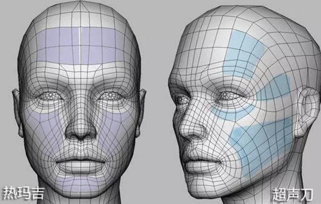 超声刀、热玛吉哪个适合你,皮肤专家这样做抗