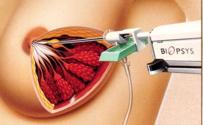 美国癌症研究院发布2019更新版：这八个癌症谣言不可信