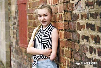 英鸟-看天下-英国-London 伦敦-热点-残疾少女