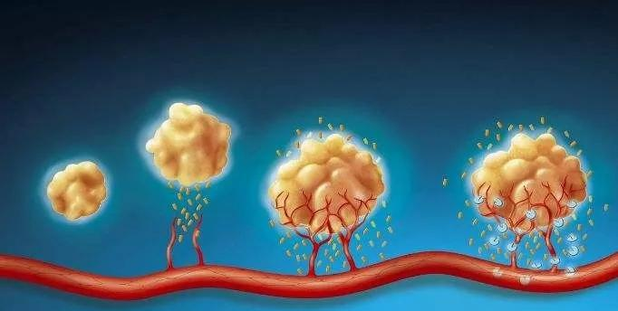 <b>肿瘤复发转移的原因到底是什么？肿瘤患者又该如何应对？</b>