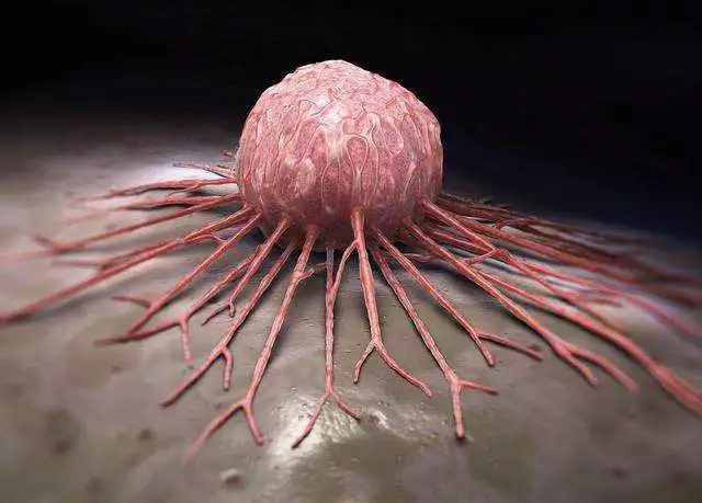 癌症该不该化疗？别再“滋养”癌细胞了！