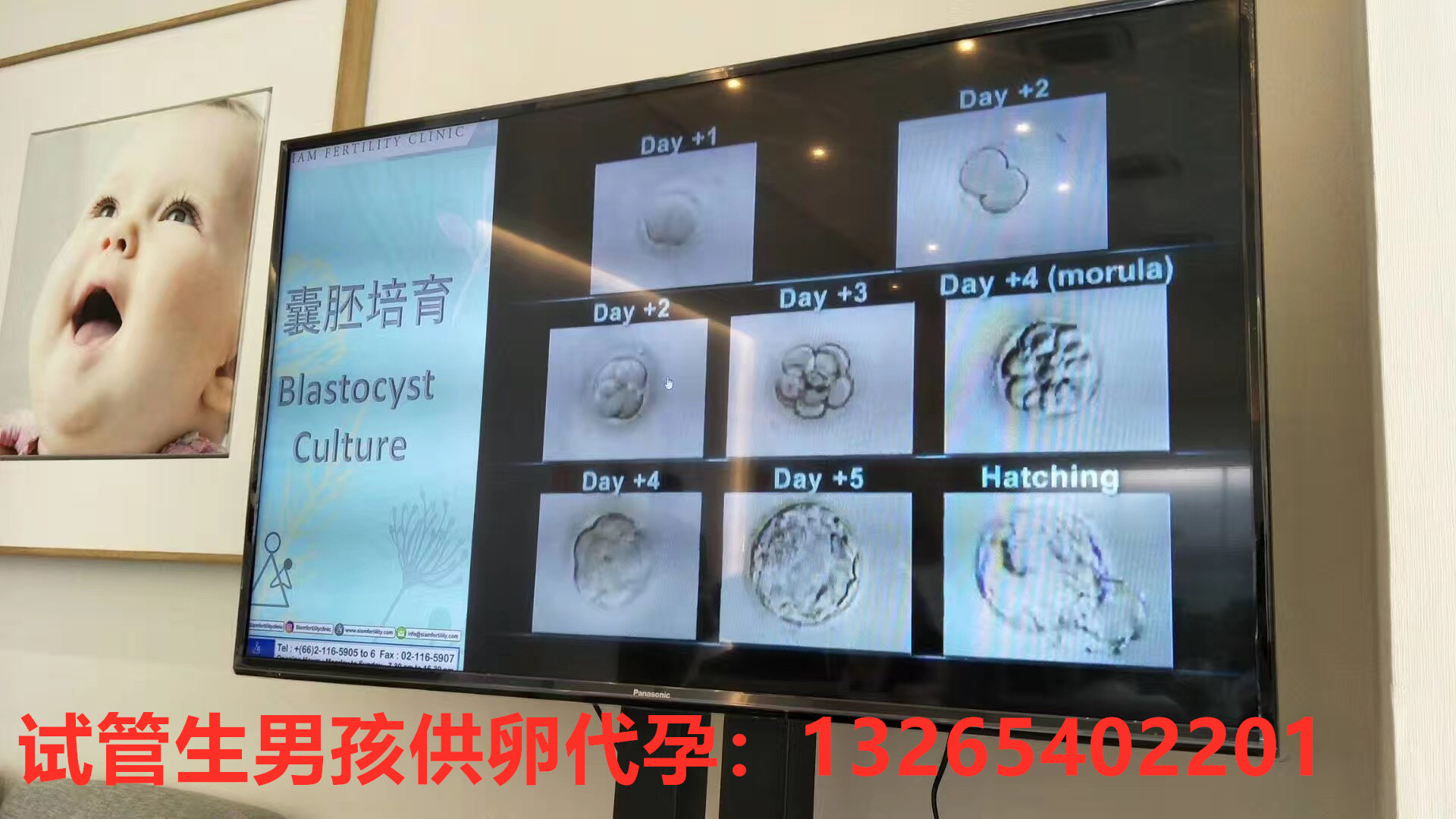 好运健康好运健康泰国试管:医生说胚胎很好,为什么还是不成功呢? 胚胎,移植,试管婴儿,患者,阶段 泰国试管移植 好运健康好运健康泰国试管:医生说胚胎很好,为什么还是不成功呢? 胚胎,移植,试管婴儿,患者,阶段 泰国试管移植