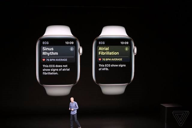 拿applewatchs4换s5最亏的以旧换新难道不知苹果四代出机神