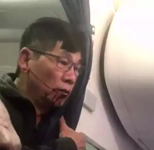 美联航打人真相曝光！群殴69岁老人只为偏袒员工占座，丑陋行为令人发指！