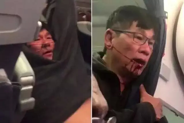 美联航打人真相曝光！群殴69岁老人只为偏袒员工占座，丑陋行为令人发指！