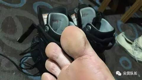 为什么总有一些人脱了鞋之后，他的脚像踩过屎一样臭…