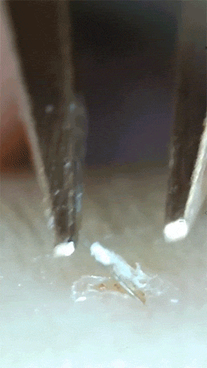 重口味的动态图图片：拔毛，慎入！